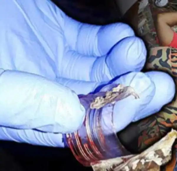 Man Rescued With Hacksaw After Getting His Manh00d Stuck In A Bottle